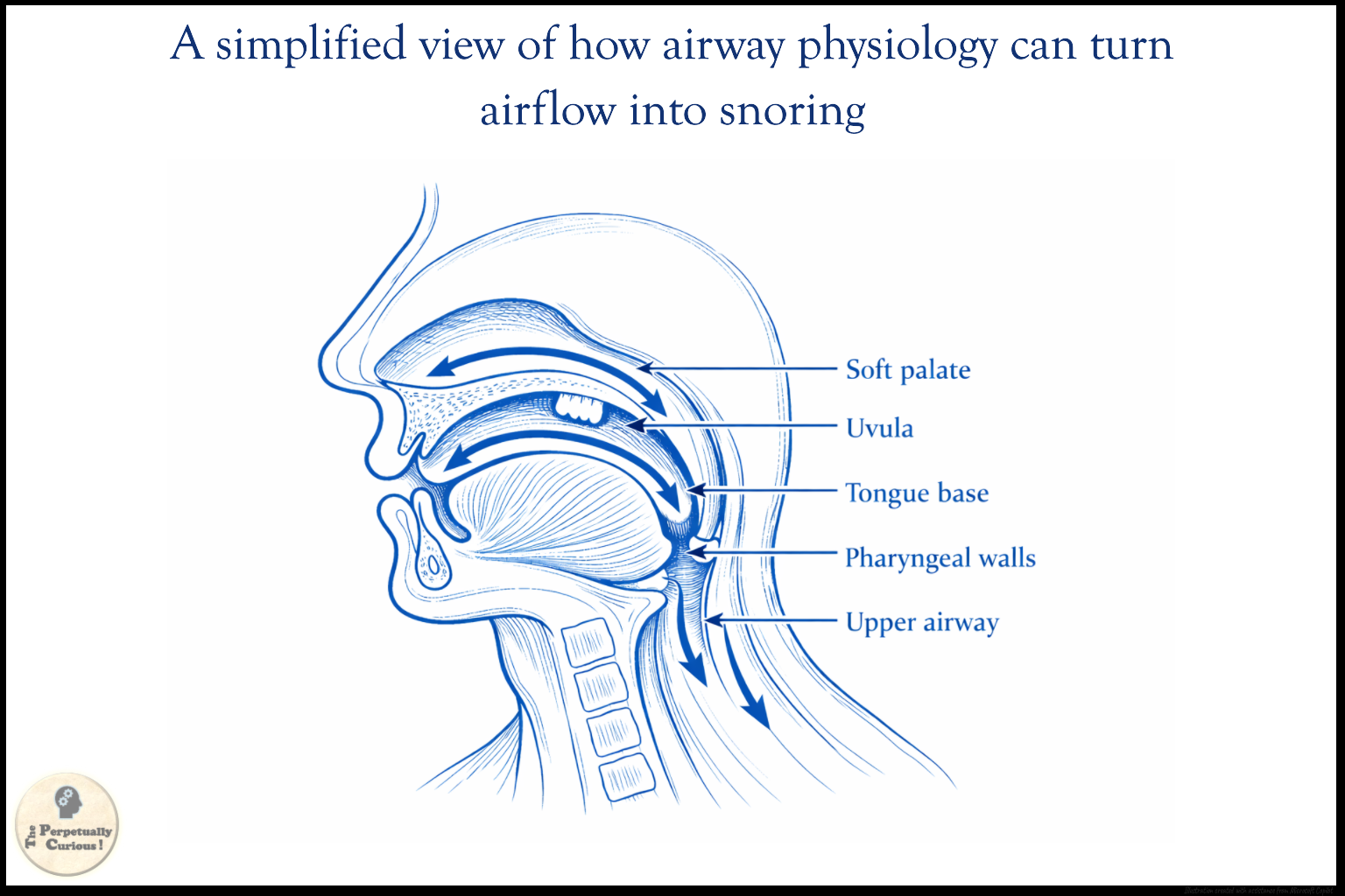 Diagram of the upper airway during sleep, showing the soft palate, uvula, tongue base, pharyngeal walls, airflow arrows, and a narrowed airway region related to snoring.
