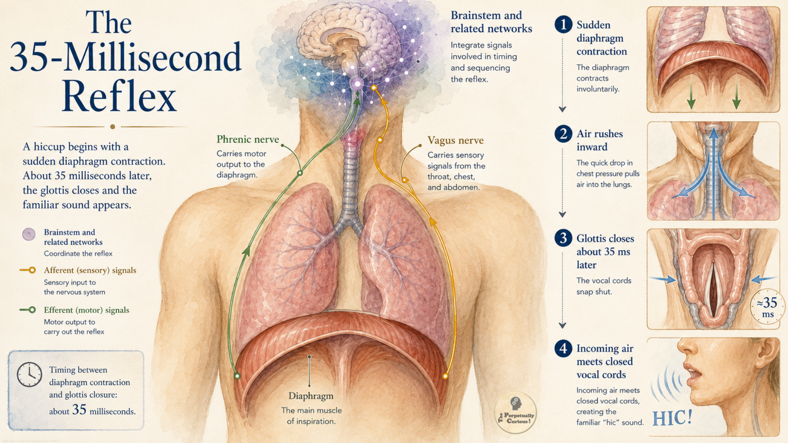 Scientific infographic rendering showing the hiccup reflex, with diaphragm contraction, inward airflow, rapid glottis closure, phrenic and vagus nerve pathways, and distributed neural coordination.