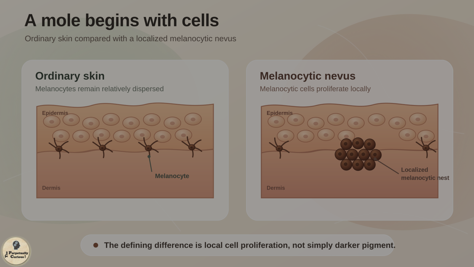 Scientific illustration comparing relatively dispersed melanocytes in ordinary skin with a localized melanocytic nest in a nevus.